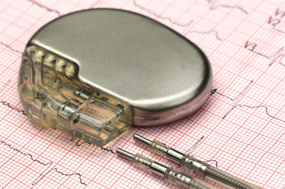 Minnesota: implantable pacemaker 
