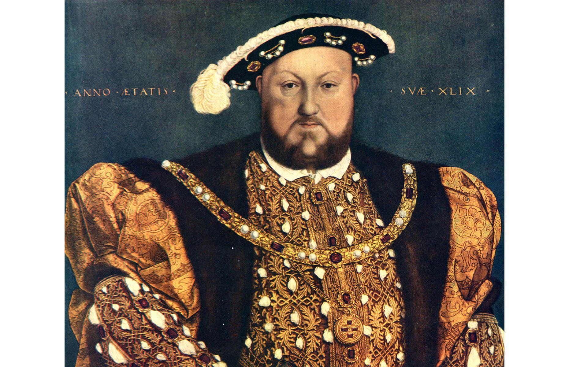 Henry VIII had syphilis